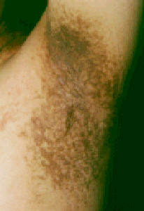 Skin A to Z - A